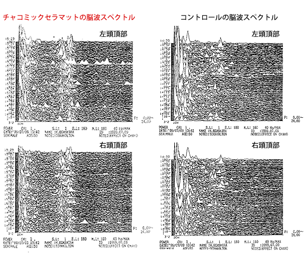 脳波の変化